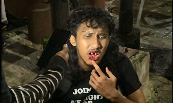 Sejumlah massa tolak UU TNI di Kota Malang, Jawa Timur, mendapatkan tindakan represifitas dan brutalitas apparat, ada juga yang ditangkap. (X@PF_PEDULI_)